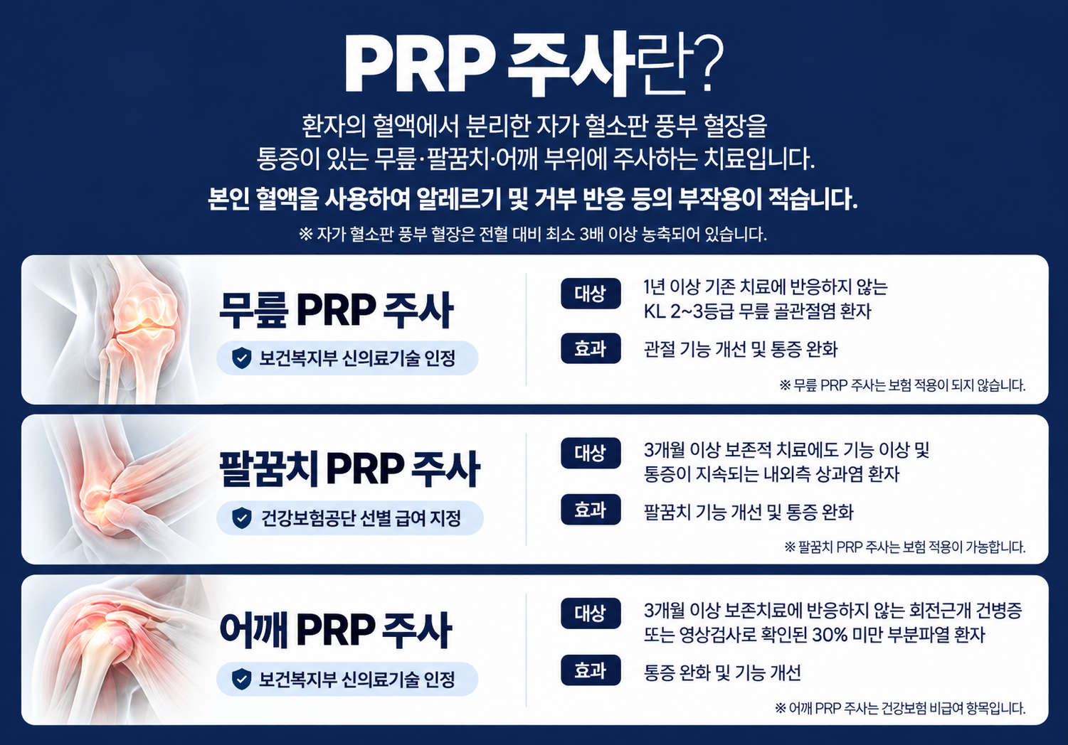 PRP주사